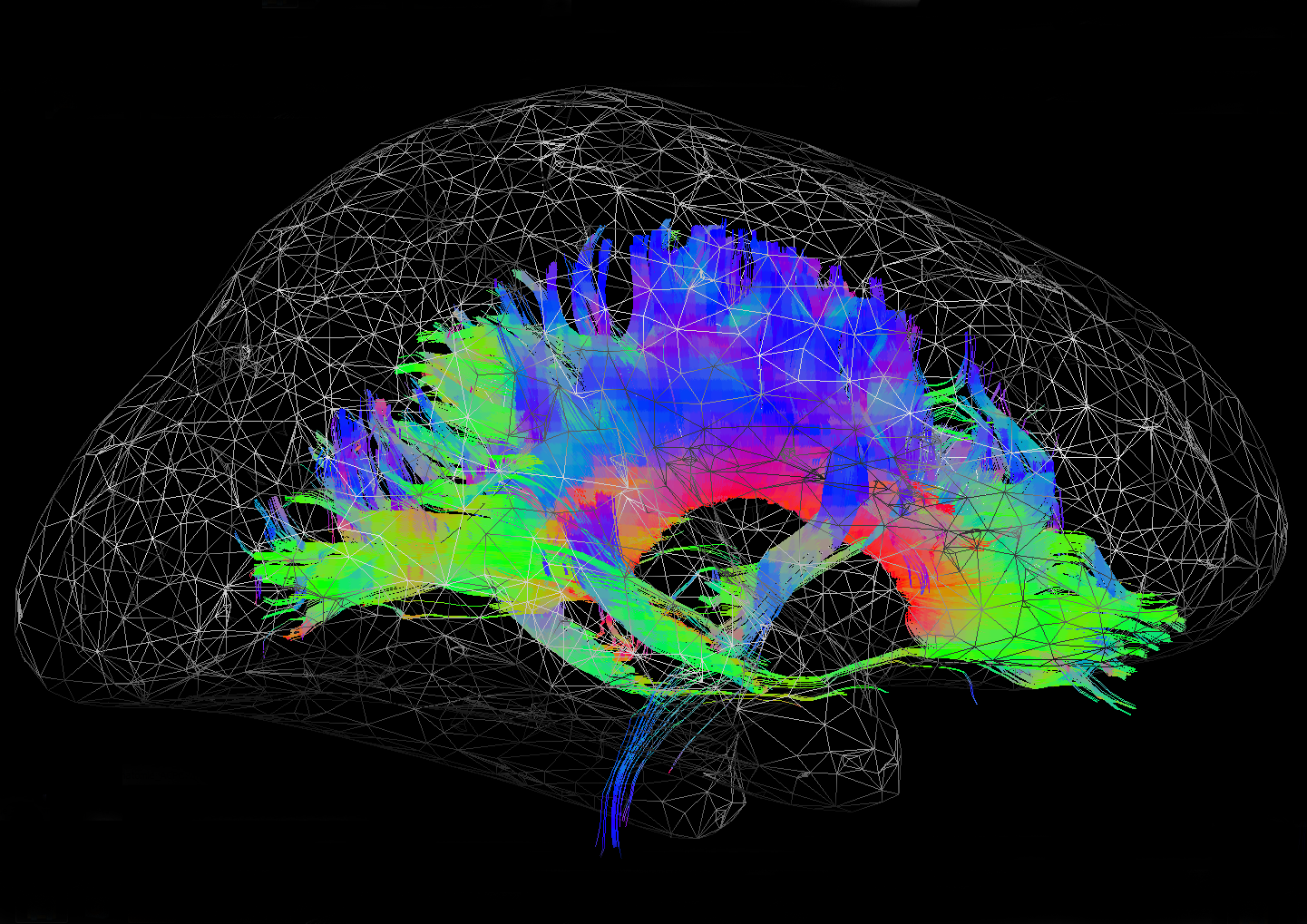 Brain Mohawk | The Neuro Bureau