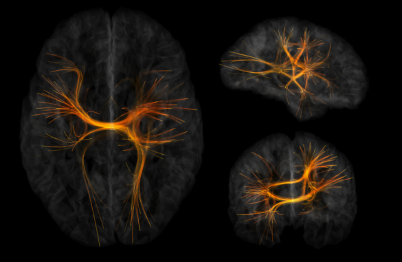 Sebastien Dery Montreal Neurological Institute