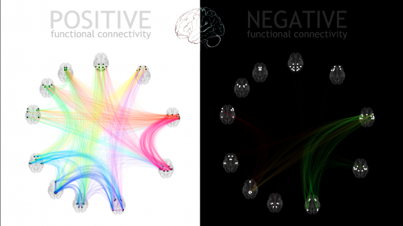 Alfonso Nieto-Castanon, The Gabrieli Lab. McGovern Institute for Brain Research. MIT