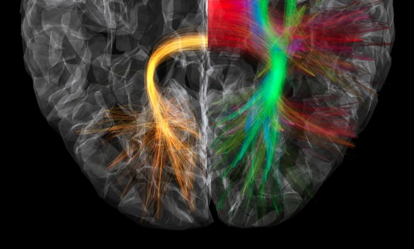 Sebastien Dery, Montreal Neurological Institute, McGill University