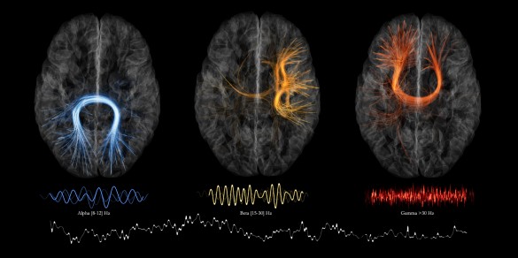 Sebastien Dery, Montreal Neurological Institute, McGill University
