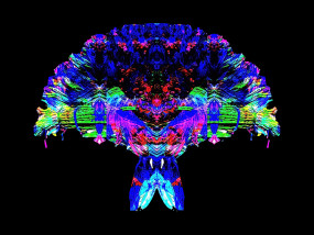 Rorschach | The Neuro Bureau