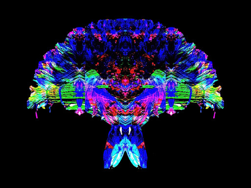 Coping With Eczema - Hemp Seed Oil Will Hydrate Eczema