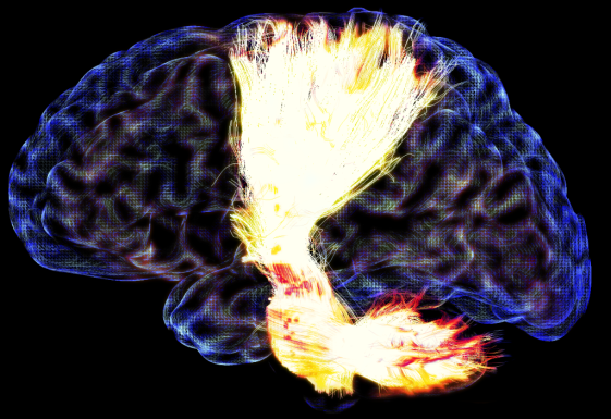 Maxime ChamberlandSherbrooke Connectivity Imaging Lab
