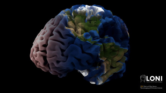 Tyler Ard University of Southern California, Laboratory of Neuro Imaging, Mark and Mary Stevens Neuroimaging a