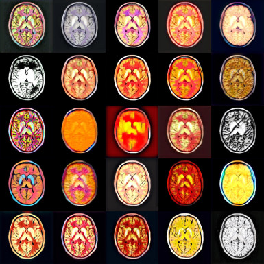 Michael RullmannDepartment of Nuclear Medicine, University of Leipzig