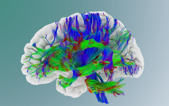 Fiber bouquet | The Neuro Bureau