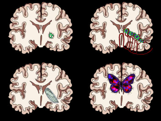 Brain Art Competition 2018 | The Neuro Bureau