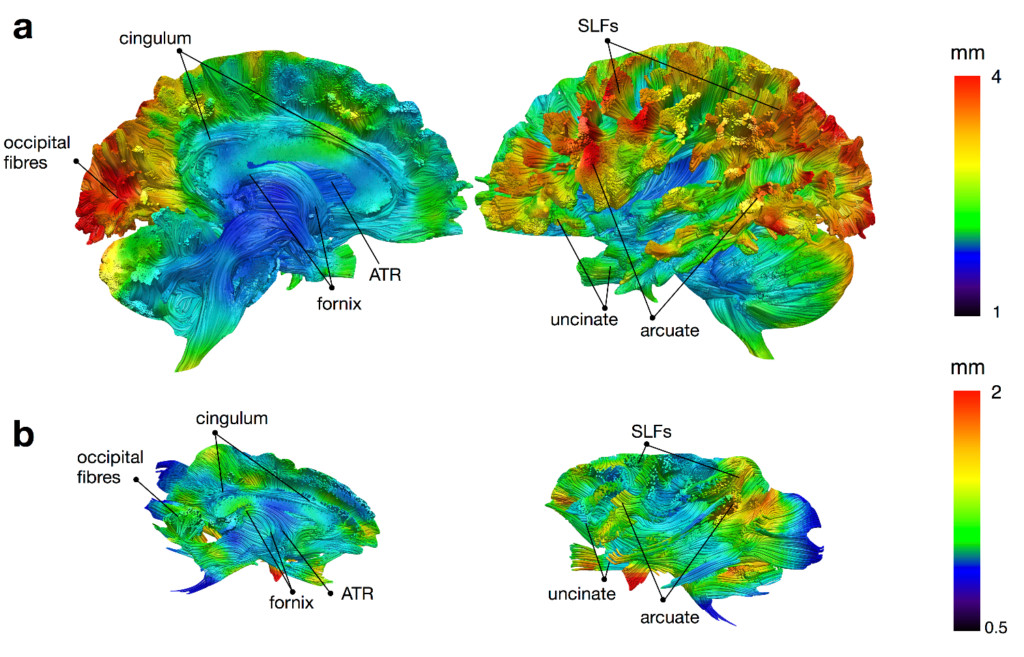 Comparative White Matter Variability | The Neuro Bureau