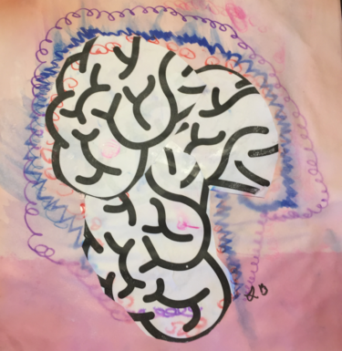 Linda Boling, retired Alzheimer/PCA sufferer