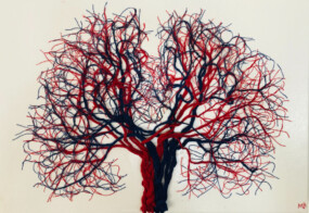 The V Tree | The Neuro Bureau