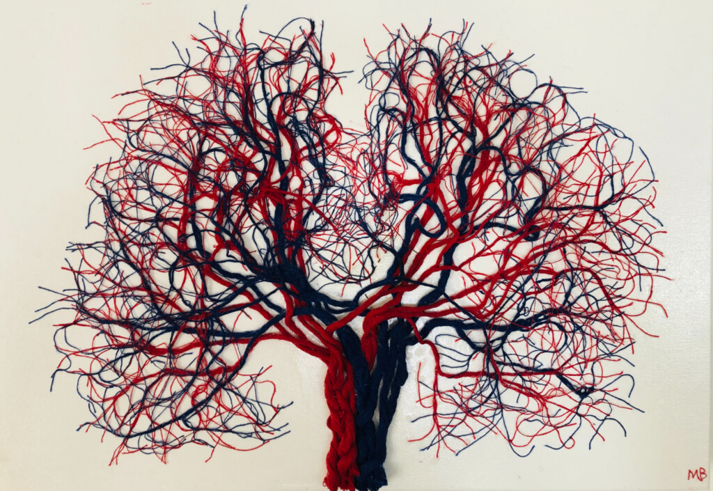 The V Tree | The Neuro Bureau