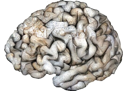 Brain Pebble Jean-Francois Mangin, Neurospin