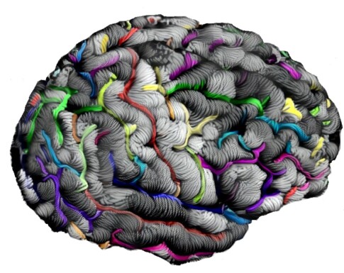 WoollyBrain Jean-Francois Mangin, Neurospin