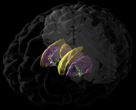 Jim Stanis, Laboratory of Neuro Imaging at the University of Southern California