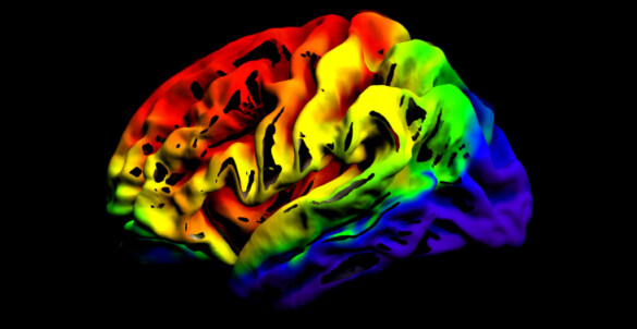 The fragmented brain Szabolcs David, UMC Utrecht