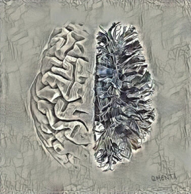 Cerebral Litograph Irina sanchez, Santi Puch & Salvis Are, QMENTA